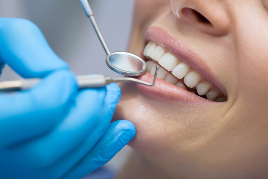 What You Should Know About Periodontal Disease