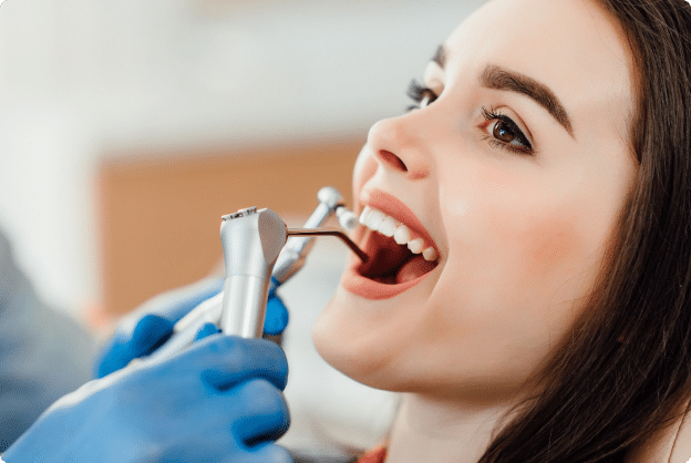 teeth cleaning Mississauga