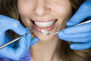 dental cleaning Mississauga