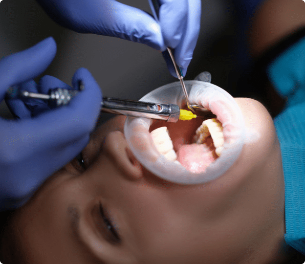 Urgent Dental Care Mississauga
